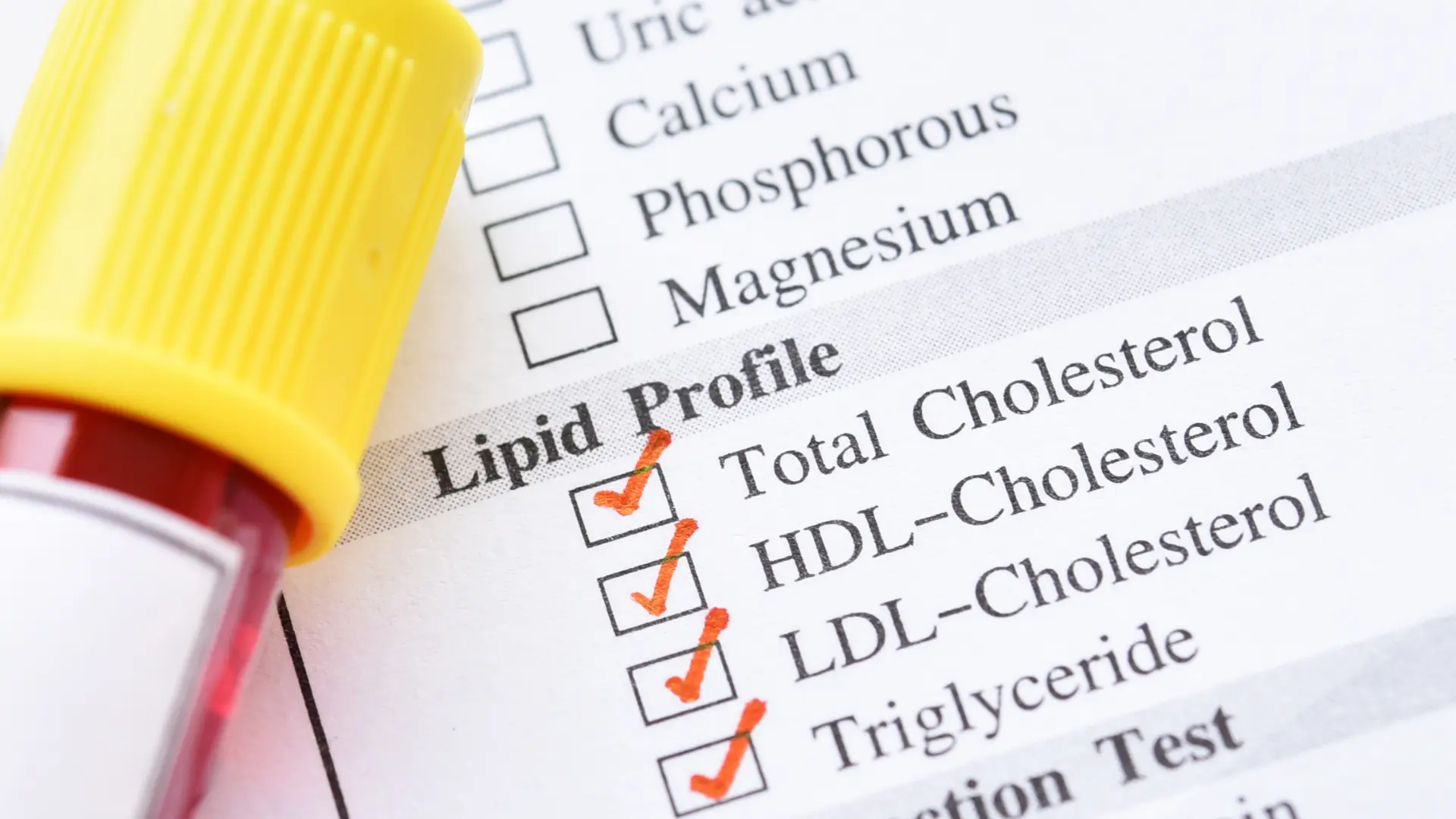 Cholesterol and Lipid Profile